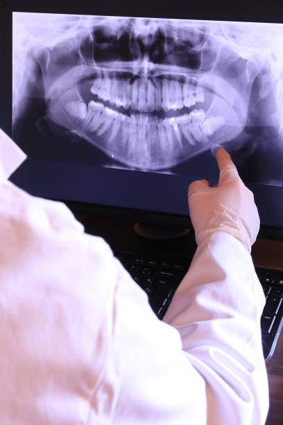 Best Emergency Care for Gum Disease in West Rson, CA
